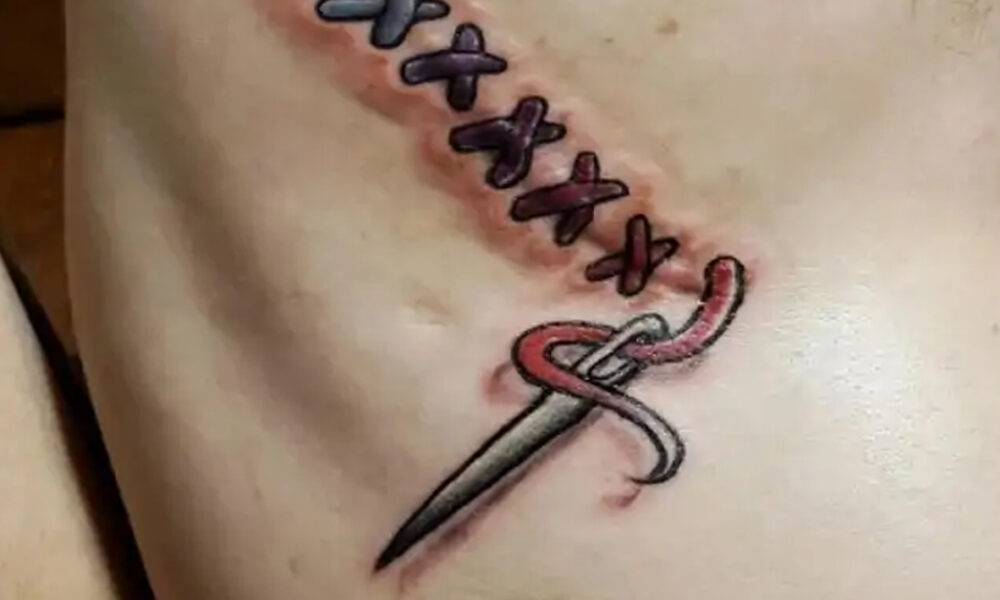 tetovania