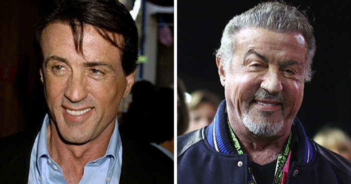 plastické operácie