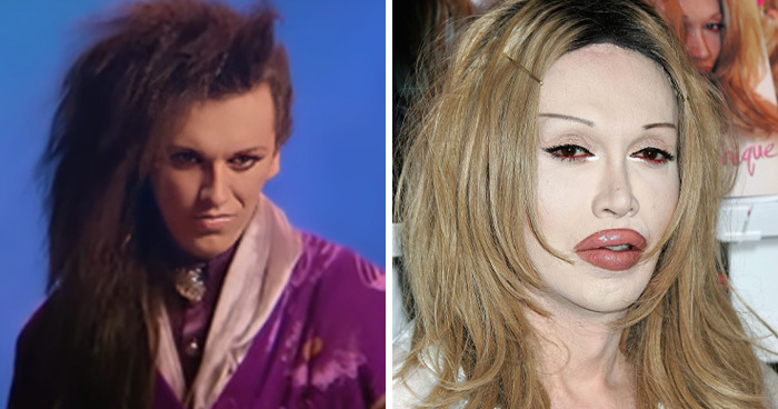 plastické operácie